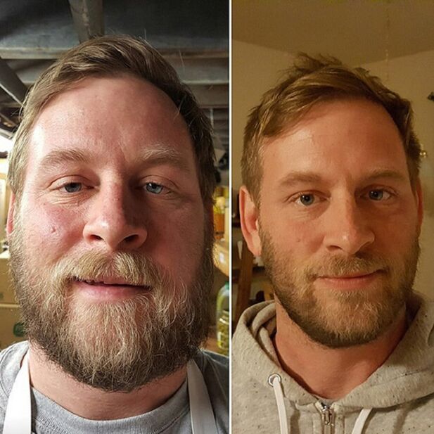 the person's appearance before and after giving up alcohol